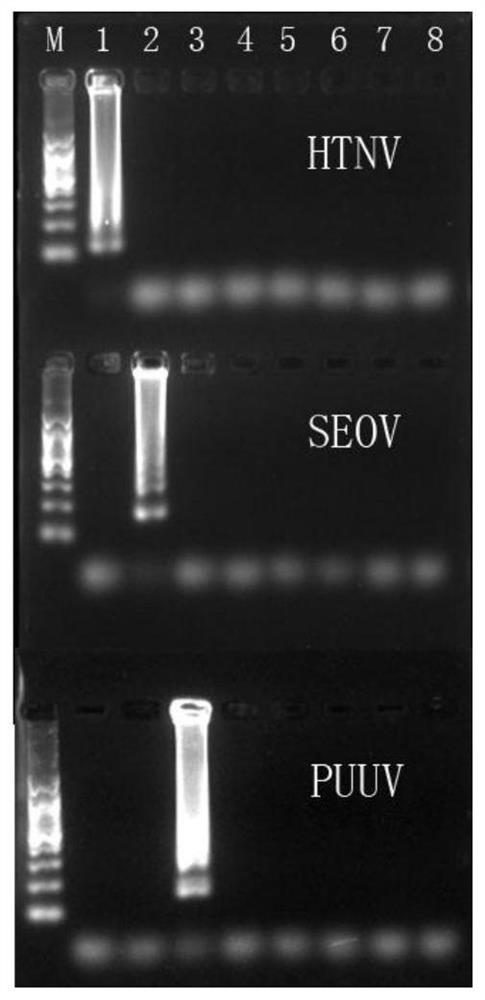 用于檢測(cè)漢坦病毒的檢測(cè)引物、檢測(cè)試劑盒及檢測(cè)方法